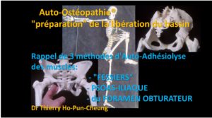 Auto-ostéopathie musculaire du Bassin: 3 techniques