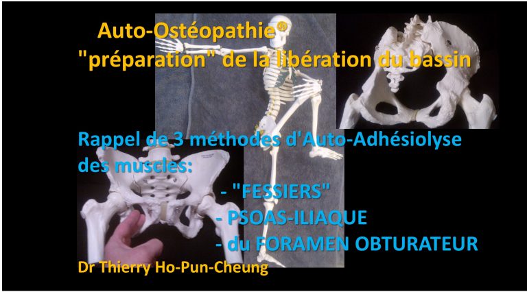 Auto-ostéopathie Musculaire Du Bassin: 3 Techniques | Adhésiolyse ...