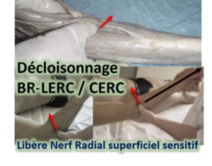 Décloisonnage entre BR-LERC/CERC/EXT DOIGTS-V/EUC +-ANCONÉ