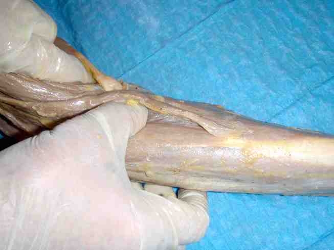 elbow-anatomy-osteopathy-5