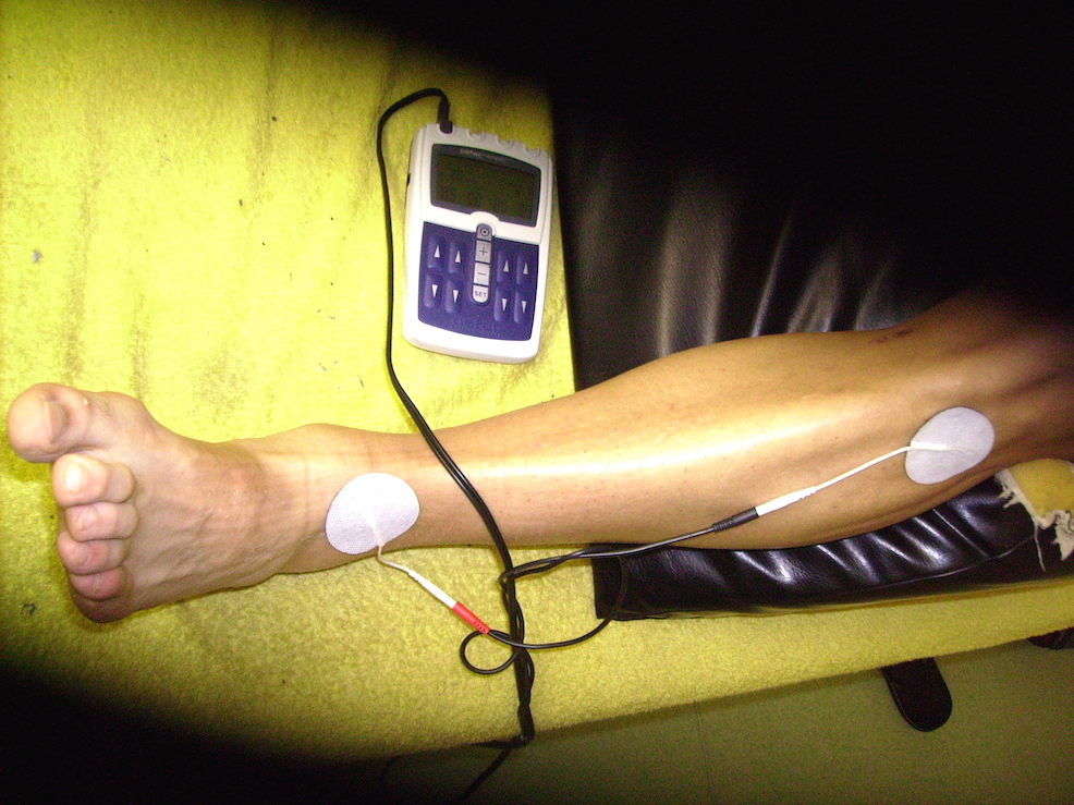electro-stimulation-painful-ankle