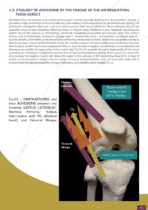 etiology of fasciae adhesions of the knee