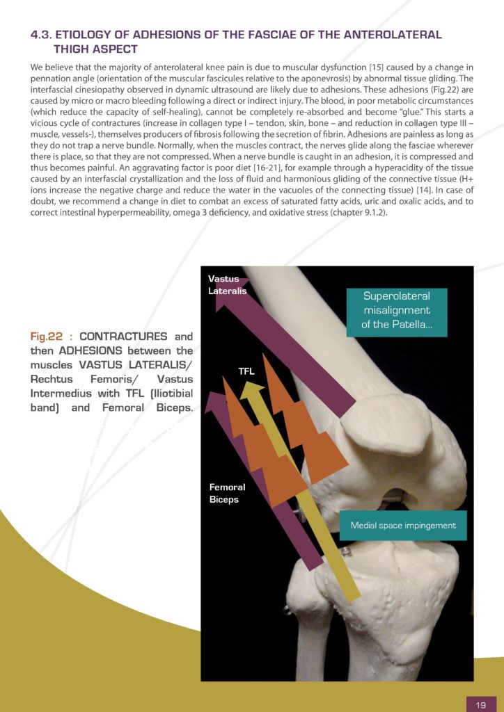 etiology of fasciae adhesions of the knee Dynamic Manual Adhesiolysis®