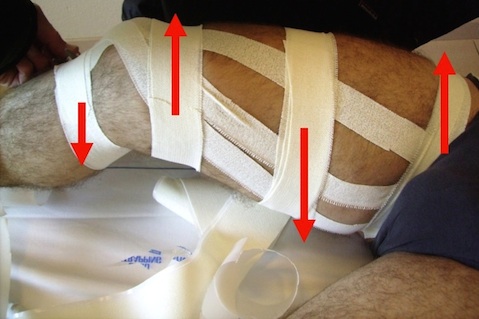 pubalgia-taping-osteopathy-6