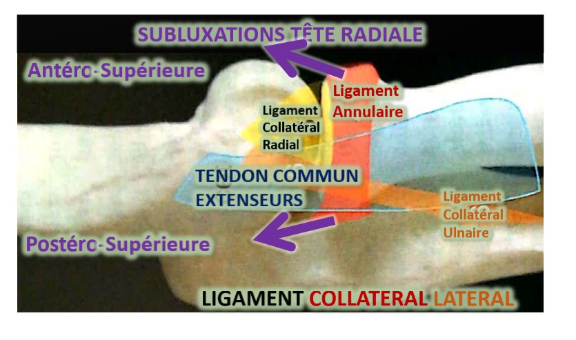 subluxations tête radiale, ostéopathie coude | Adhésiolyse Manuelle ...